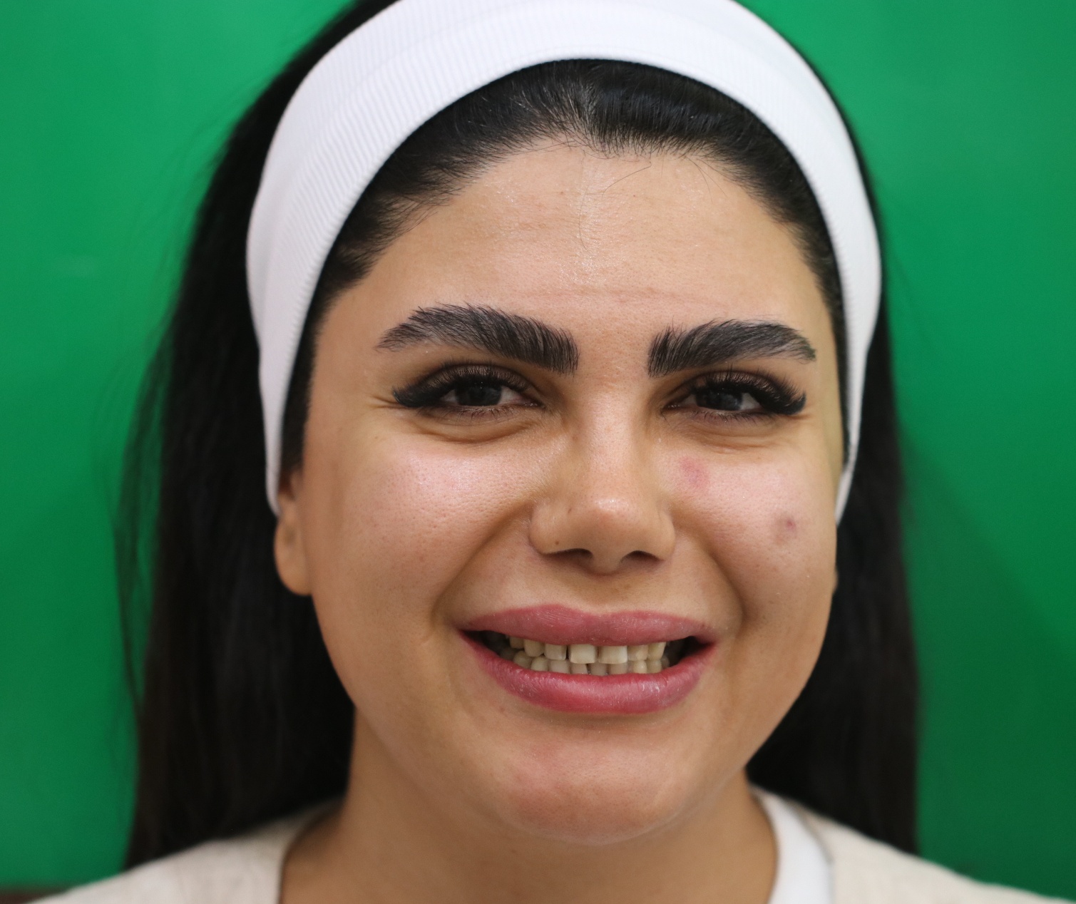 لمینیت سرامیک —